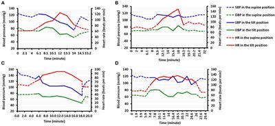 Clinical Features of Patients Undergoing the Head-Up Tilt Test and Its Safety and Efficacy in Diagnosing Vasovagal Syncope in 4,873 Patients